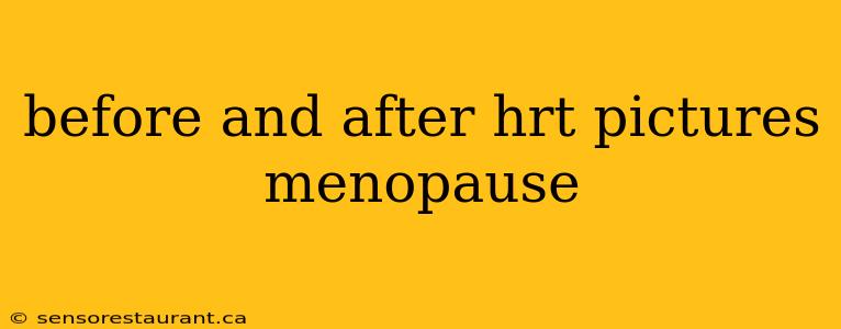 before and after hrt pictures menopause