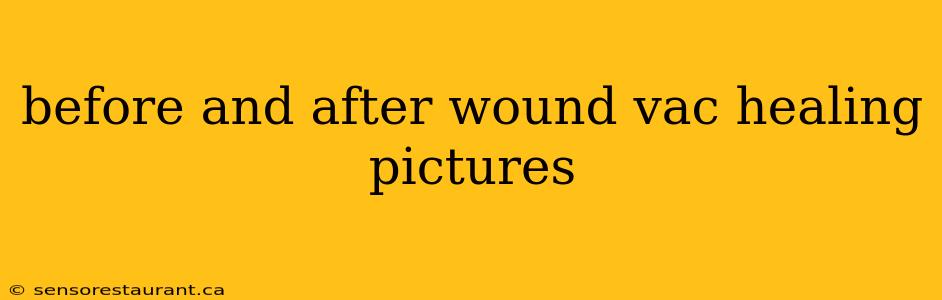 before and after wound vac healing pictures