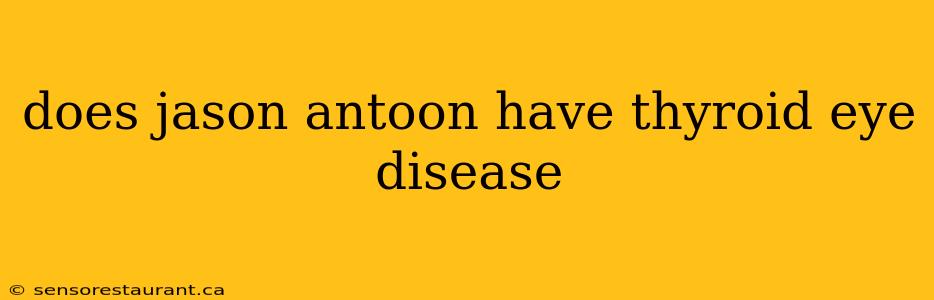 does jason antoon have thyroid eye disease