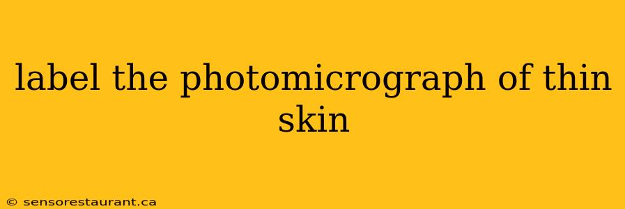 label the photomicrograph of thin skin