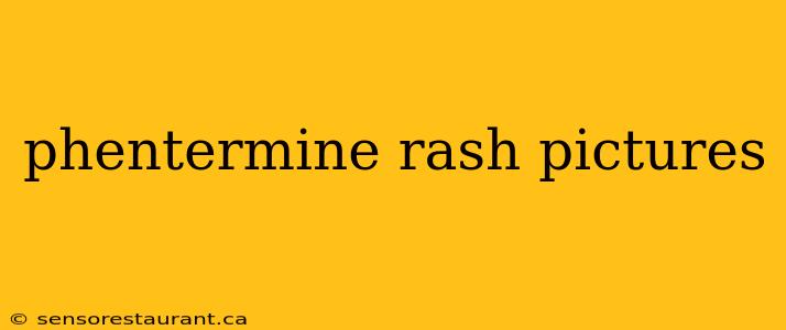 phentermine rash pictures