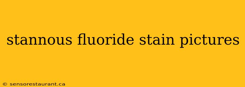 stannous fluoride stain pictures