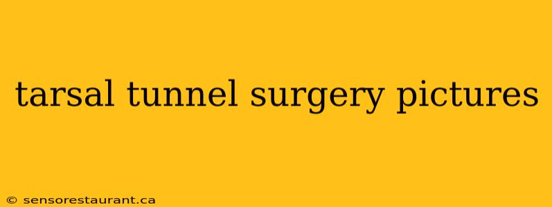 tarsal tunnel surgery pictures