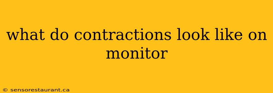 what do contractions look like on monitor