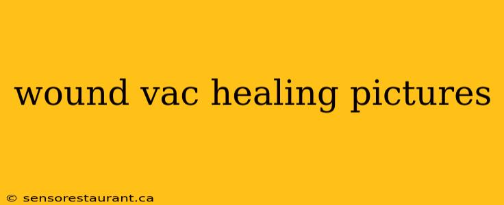 wound vac healing pictures